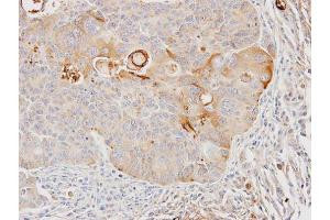 IHC-P Image Immunohistochemical analysis of paraffin-embedded SW480 xenograft, using GSTA4, antibody at 1:100 dilution.