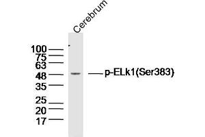 Mouse brain lysates probed with Elk1(Ser383) Polyclonal Antibody, unconjugated  at 1:300 overnight at 4°C followed by a conjugated secondary antibody at 1:10000 for 90 minutes at 37°C. (ELK1 anticorps  (pSer383))