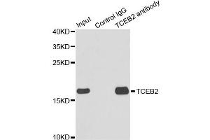 Immunoprecipitation analysis of 150ug extracts of MCF7 cells using 3ug TCEB2 antibody. (TCEB2 anticorps)