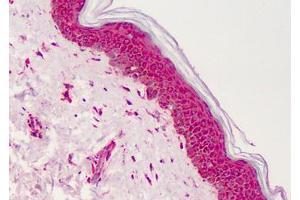 Human Skin: Formalin-Fixed, Paraffin-Embedded (FFPE) (PPARG anticorps  (Internal Region))