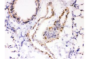 Anti- ATP2A2 antibody,IHC(P) IHC(P): Mouse Lung Tissue