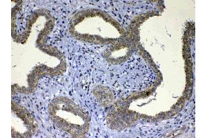 IHC analysis of UGT1A1 using anti-UGT1A1 antibody .