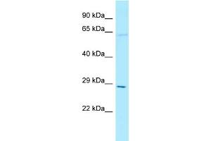 WB Suggested Anti-THTPA Antibody Titration: 1. (THTPA anticorps  (N-Term))