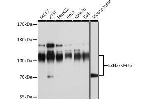 Western blot analysis of extracts of various cell lines, using EZH2/KMT6 antibody (ABIN6133509, ABIN6140393, ABIN6140396 and ABIN6215059) at 1:1000 dilution. (EZH2 anticorps  (AA 1-250))