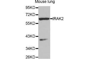 Western Blotting (WB) image for anti-Interleukin-1 Receptor-Associated Kinase 2 (IRAK2) (AA 1-270) antibody (ABIN3016607) (IRAK2 anticorps  (AA 1-270))