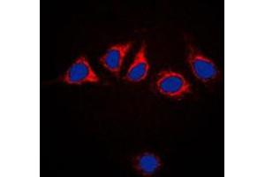 Immunofluorescent analysis of Calnexin staining in HeLa cells. (Calnexin anticorps  (C-Term))