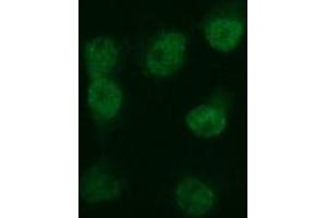 Image no. 3 for anti-Tubulin, beta 2B (TUBB2B) antibody (ABIN1501572) (TUBB2B anticorps)