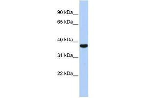 EXOSC2 antibody used at 1 ug/ml to detect target protein. (EXOSC2 anticorps  (Middle Region))