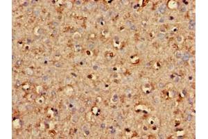 Immunohistochemistry of paraffin-embedded human brain tissue using ABIN7170725 at dilution of 1:100 (STMN2 anticorps  (AA 61-129))