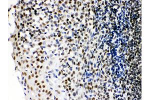 Anti- Ku70 Picoband antibody, IHC(P) IHC(P): Human Tonsil Tissue (XRCC6 anticorps  (C-Term))