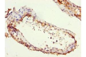 Immunohistochemistry of paraffin-embedded human testis tissue using ABIN7176044 at dilution of 1:100 (ZCCHC13 anticorps  (AA 1-166))