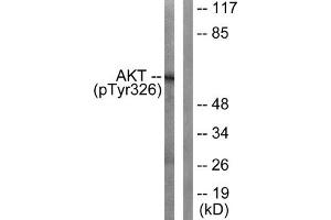 Western blot analysis of extracts from mouse liver cells, using Akt (Phospho-Tyr326) antibody. (AKT1 anticorps  (pTyr326))