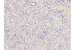 Immunohistochemistry of paraffin-embedded human kidney using FAS antibody at dilution of 1:400 (200x lens). (FAS anticorps  (AA 150-250))