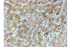 ABIN184571 (2µg/ml) staining of paraffin embedded Human Liver. (GADD34 anticorps  (C-Term))