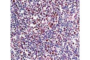 RUNX2 antibody immunohistochemistry analysis in formalin fixed and paraffin embedded human tonsil tissue.