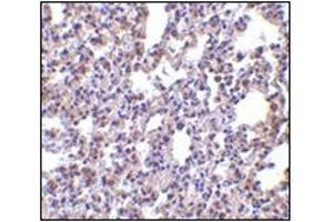 Immunohistochemistry of PKR in rat lung tissue with this product at 2. (EIF2AK2 anticorps  (C-Term))
