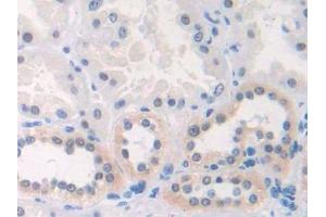 DAB staining on IHC-P; Samples: Human Kidney Tissue (CX3CL1 anticorps  (AA 81-336))