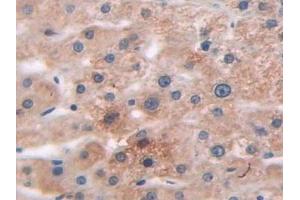 Detection of ARRb1 in Human Liver Tissue using Polyclonal Antibody to Arrestin Beta 1 (ARRb1)