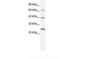 Image no. 1 for anti-Gap Junction Protein, delta 3, 31.9kDa (GJD3) (AA 31-80) antibody (ABIN202183) (Gap Junction Protein, delta 3, 31.9kDa (GJD3) (AA 31-80) anticorps)