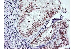 Image no. 3 for anti-Ring Finger Protein 113B (RNF113B) antibody (ABIN1500715) (RNF113B anticorps)