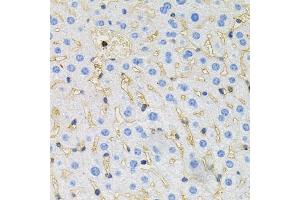 Immunohistochemistry of paraffin-embedded mouse liver using MAPT antibody (ABIN5970456) at dilution of 1/100 (40x lens). (MAPT anticorps)
