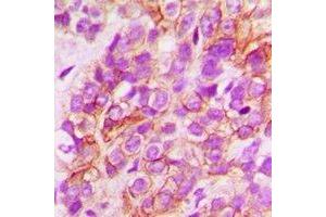 Immunohistochemistry (IHC) image for anti-N-Myc Downstream Regulated 1 (NDRG1) antibody (ABIN7308066)