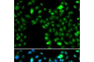 Immunofluorescence analysis of MCF-7 cells using ING5 Polyclonal Antibody (ING5 anticorps)