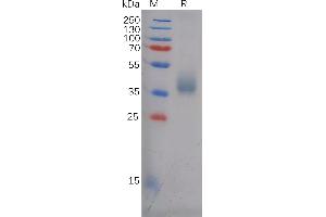Human AN Protein, His Tag on SDS-PAGE under reducing condition.