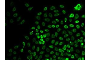 Immunofluorescence analysis of HeLa cells using BRG1/BRG1/SM antibody (ABIN6133730, ABIN6148100, ABIN6148101 and ABIN7101348). (SMARCA4 anticorps  (AA 30-130))