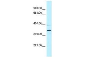 Image no. 1 for anti-Protein Phosphatase 2A Activator, Regulatory Subunit 4 (PPP2R4) (AA 39-88) antibody (ABIN6747835) (PPP2R4 anticorps  (AA 39-88))