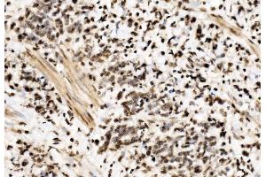 IHC analysis of SPHK1 using anti-SPHK1 antibody (ABIN7600168).