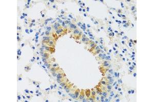Immunohistochemistry of paraffin-embedded Mouse lung using CAMK1 Polyclonal Antibody at dilution of 1:100 (40x lens).