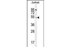 DARS Antibody (N-term) (ABIN655040 and ABIN2844671) western blot analysis in Jurkat cell line lysates (35 μg/lane). (DARS anticorps  (N-Term))