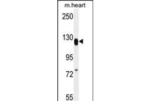MED14 Antibody (Center) (ABIN656136 and ABIN2845475) western blot analysis in mouse heart tissue lysates (35 μg/lane). (MED14 anticorps  (AA 586-615))