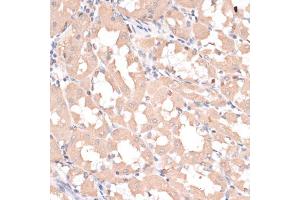 Immunohistochemistry of paraffin-embedded human stomach using ABCC1 antibody (ABIN5997171) at dilution of 1/100 (40x lens). (ABCC1 anticorps)