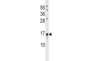Western Blotting (WB) image for anti-Osteocalcin (BGLAP) antibody (ABIN3001265) (Osteocalcin anticorps)