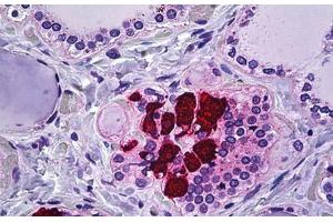 Human Thyroid, C-cells: Formalin-Fixed, Paraffin-Embedded (FFPE) (CIB2 anticorps  (AA 21-70))
