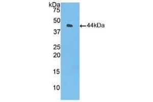 Detection of Recombinant C3, Human using Polyclonal Antibody to Complement Component 3 (C3) (C3 anticorps  (AA 1000-1326))