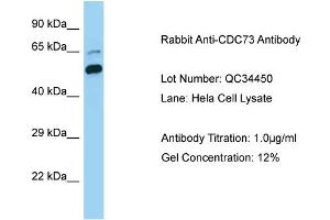 Host: Rabbit Target Name: CDC73 Sample Type: Human Hela Cell Antibody Dilution: 1. (HRPT2 anticorps  (C-Term))