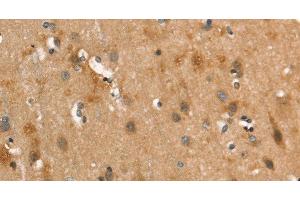 Immunohistochemistry of paraffin-embedded Human brain using CALCRL Polyclonal Antibody at dilution of 1:40 (CALCRL anticorps)