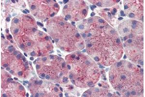 Stomach: Formalin-Fixed, Paraffin-Embedded (FFPE) (ERP44 anticorps  (Internal Region))