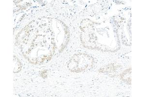Immunohistochemistry (IHC) image for anti-Bromodomain Containing 7 (BRD7) (AA 601-651) antibody (ABIN7453996) (Recombinant BRD7 anticorps  (AA 601-651))