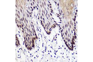 Immunohistochemistry of paraffin-embedded Human esophageal using TKT Rabbit pAb (ABIN6128870, ABIN6149201, ABIN6149203 and ABIN6221921) at dilution of 1:50 (40x lens).