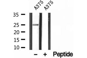 Western blot analysis of extracts of A375 cells, using ALR antibody. (GFER anticorps  (C-Term))