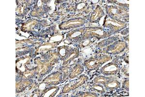 IHC analysis of FATP4/SLC27A4 using anti-FATP4/SLC27A4 antibody (ABIN7600117).