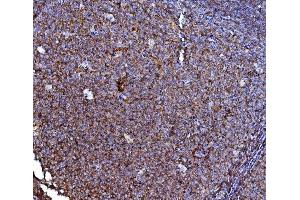 IHC analysis of CD40/TNFRSF5 using anti-CD40/TNFRSF5 antibody (ABIN4886525).