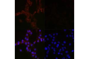 Immunofluorescence analysis of C6 cells using MLC3B Mouse mAb (ABIN7268520) at dilution of 1:100 (40x lens).