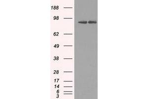 Western Blotting (WB) image for anti-Heat Shock Protein 90kDa alpha (Cytosolic), Class B Member 1 (HSP90AB1) antibody (ABIN1498739)