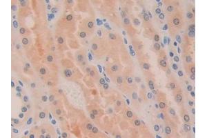 Detection of DDT in Human Kidney Tissue using Polyclonal Antibody to D-Dopachrome Tautomerase (DDT)