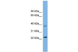 WB Suggested Anti-TFDP3 Antibody Titration: 0. (TFDP3 anticorps  (N-Term))